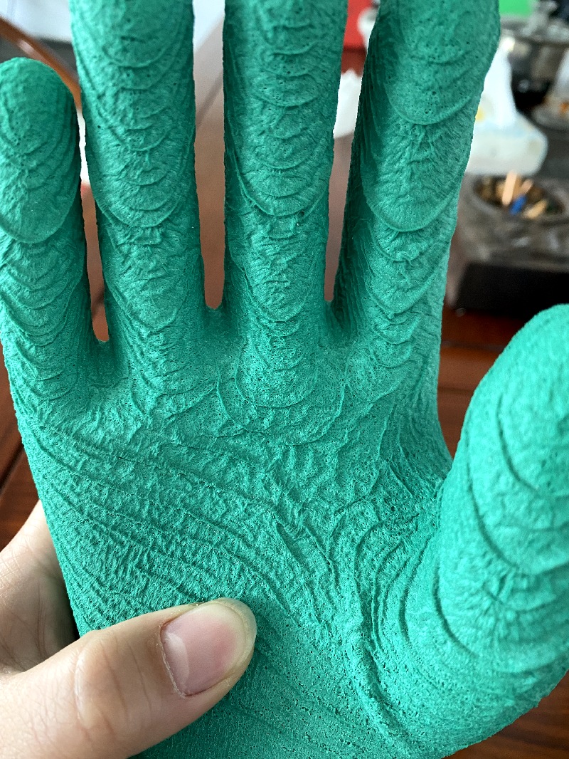Small gloves, big responsibility - the extraordinary significance of latex gloves